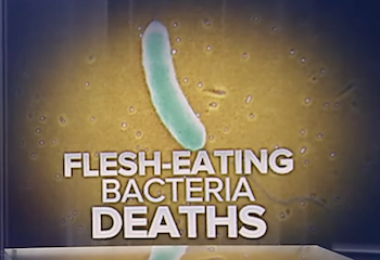 Flesh-Eating Bacteria